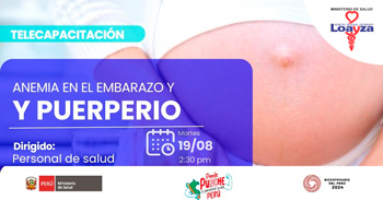 Capacitación online gratis "Anemia en el embarazo y puerperio" del Hospital Nacional Arzobispo Loayza